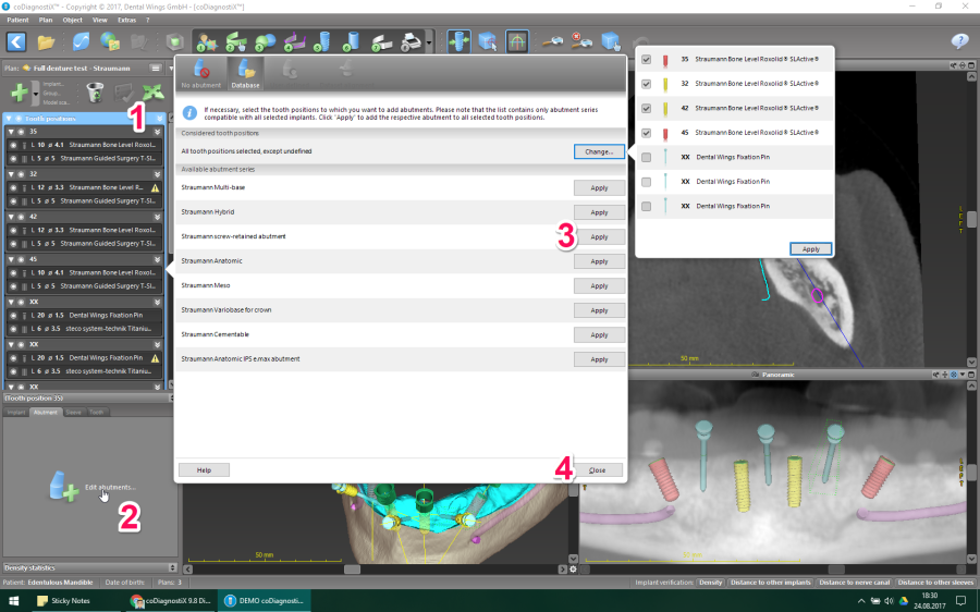 abutments.png abutments.png