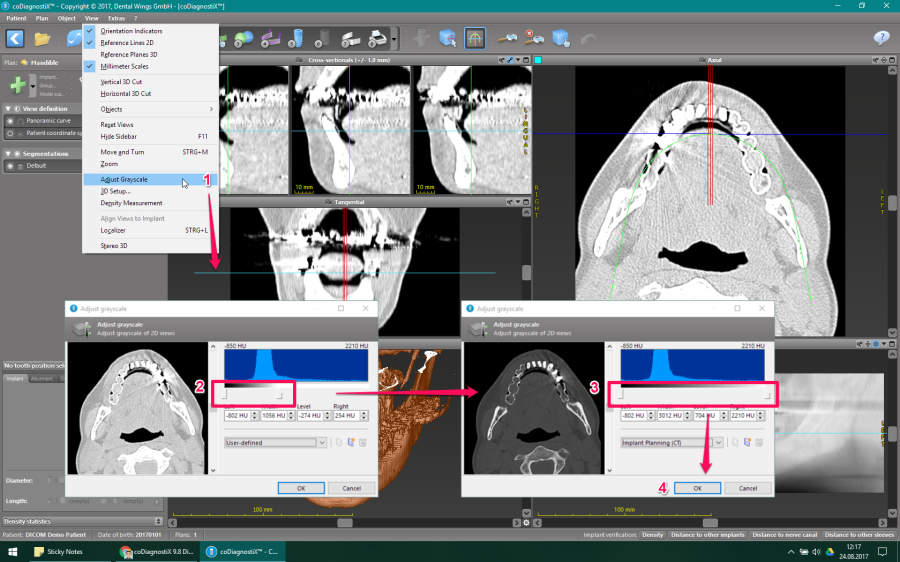 native_dicom_data.png native_dicom_data.png
